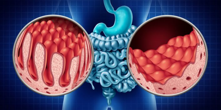 microbiote intestinal